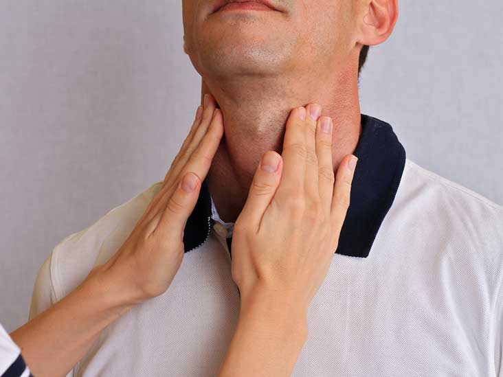 Hypothyroidism Treatment in Hyderabad